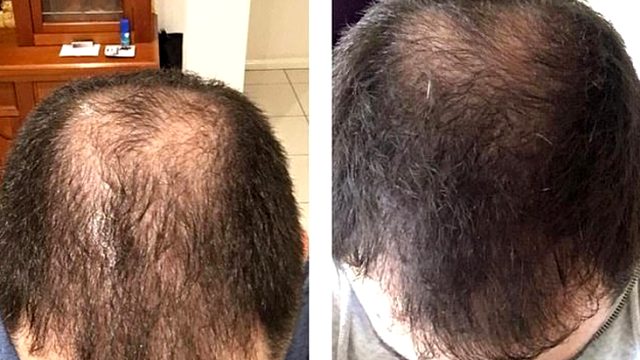 Avustralyalı girişimci, geliştirdiği saç spreyi sayesinde 5 ayda 5 milyon dolar kazandı